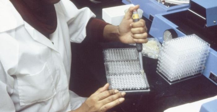 principles and methods of sandwich elisa