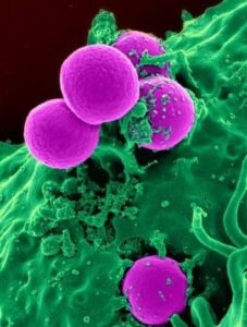 urinary tract infections