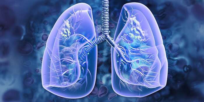 lung cancer screening Singapore